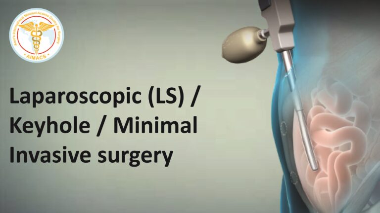 Recovery after Laparoscopic Cholecystectomy. What to expect ...